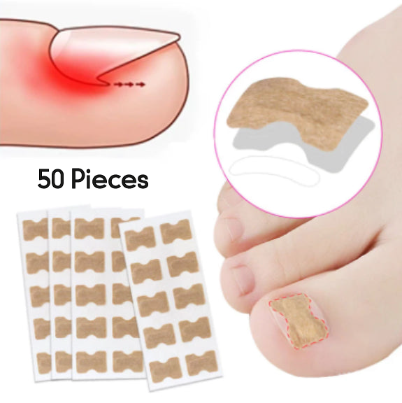 Ingrown Nail Correction Patches | 50 Stuks