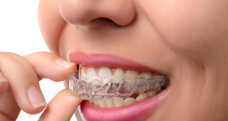 Beschermkap tegen tandenknarsen | Tegen onvrijwillige wrijving