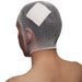 malla-tubular-cabeza-adultos-torax-ortoprime